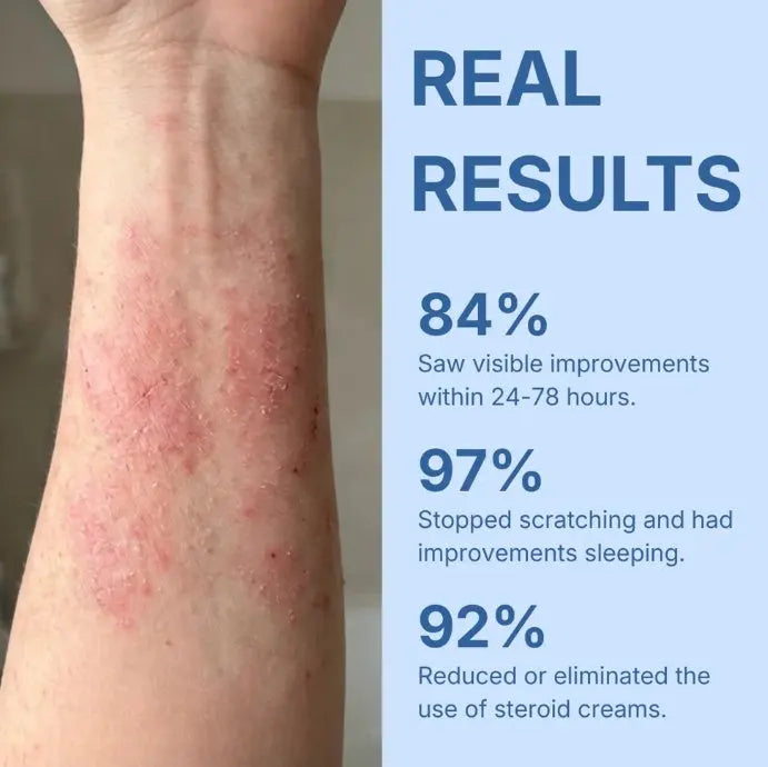 Soothing Blend Cream - Nevorashop
